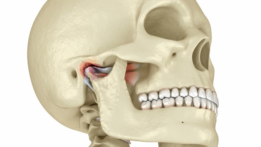 Temporomandibular joints arthritis and dislocated articular disc. Dental 3D animation Royalty-Free Stock Footage #1104081497