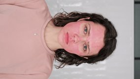 Vertical video Close-Up Portrait Sad Young Woman with pain Skin real Damage Burns from Unsuccessful DIY Beauty Treatments, Chemical Peel Dermapen. Female Unfortunate Skin Home Care Mistakes 9x16 OMG  - Powered by Shutterstock - Get 15% off with code: PIKWIZARD15