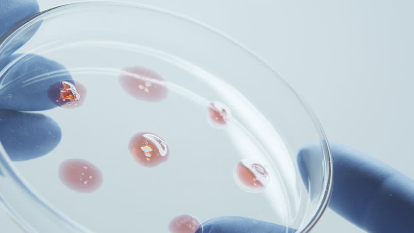 Bacteria and microbial cultures growth on a petri dish in microbiology lab. Candida auris. Biomarker. Bio-reagent. Fungus and mold. Cyanobacteria Colony. Culture medium plate. Close-up. Royalty-Free Stock Footage #1104131959