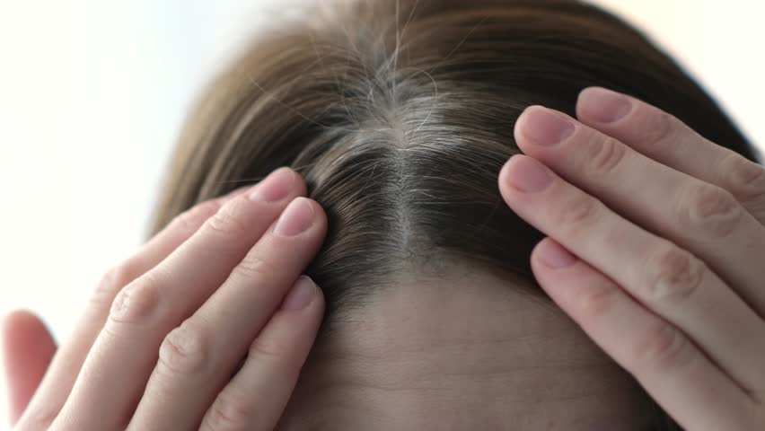 Gray hairs on the head of a young girl. Long gray hair. The initial stage of gray hair. The problem of gray hair in women. Royalty-Free Stock Footage #1104295313
