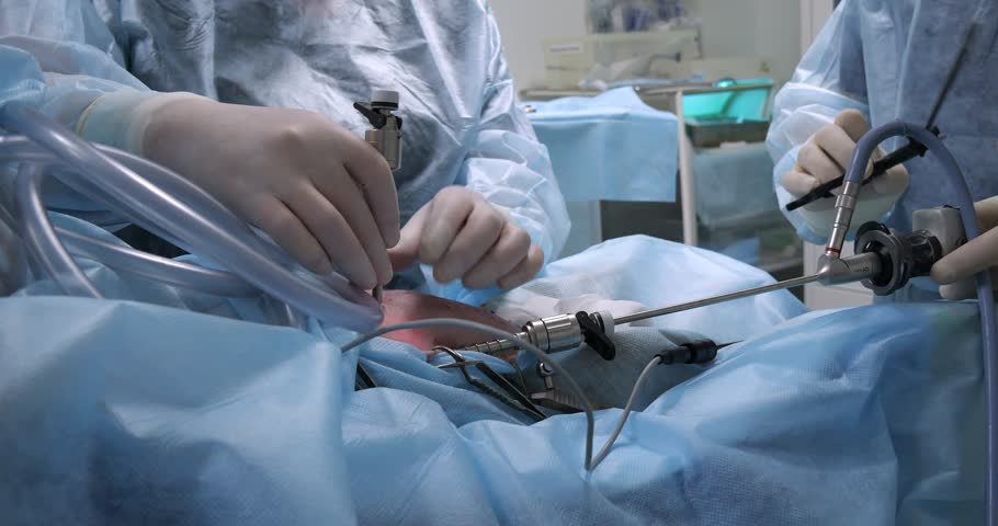 Side view. Endoscopic sterilization of a dog. The work of a team of veterinarians in surgery on endoscopic surgery in a pet. Installation of an endoscopic instrument in the abdominal wall of a dog. Royalty-Free Stock Footage #1104418827
