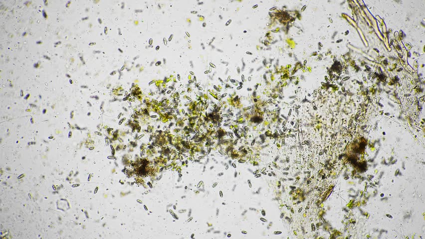 Group of infusoria moving fast and chaotically and eating seaweed filmed under microscope against bright field. Varity of primitive microorganisms swimming in aqua and consuming algae. Flora and fauna