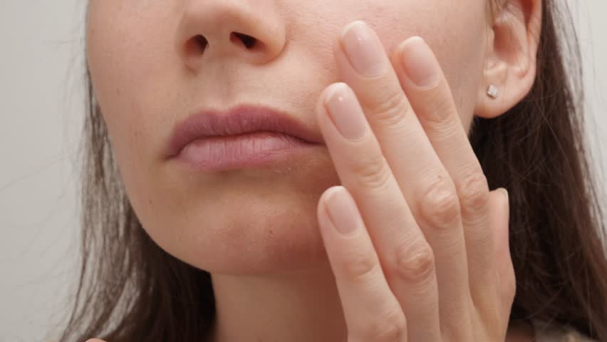 A young Caucasian woman touches her face with her hands. Skin peels