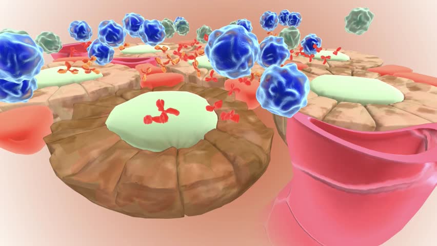Autoimmune Attack on Thyroid Cells | Shutterstock HD Video #1104861079