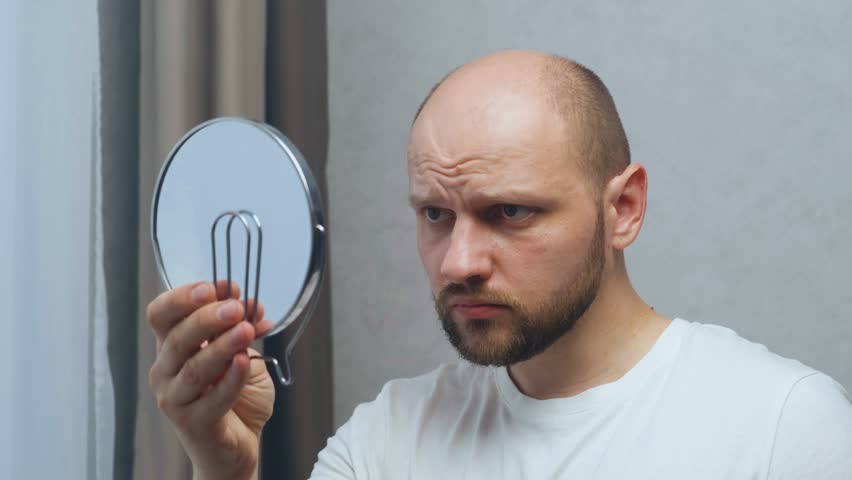 A young attractive man of Caucasian appearance with a beard, sadly examines his balding head. He touches her with his hands. He looks into the mirror with sad eyes. Alopecia due to stress | Shutterstock HD Video #1104914241