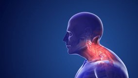 Cervical postural syndrome or neck pain - Powered by Shutterstock - Get 15% off with code: PIKWIZARD15