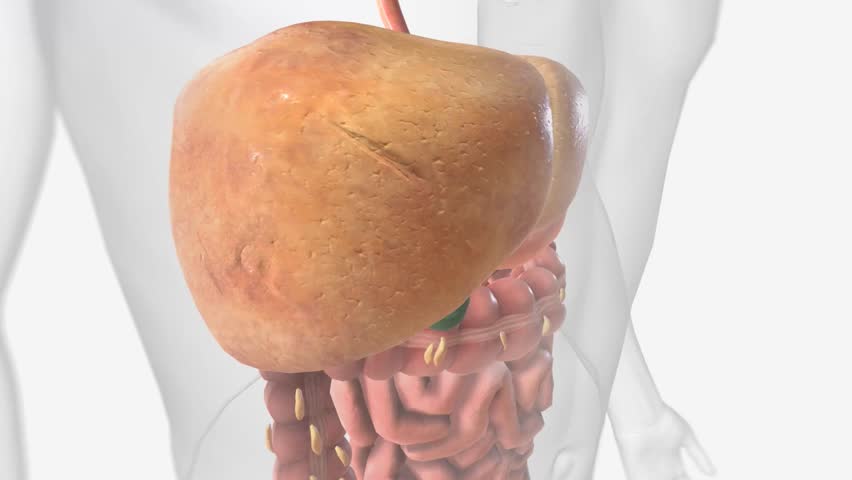 Nonalcoholic Fatty Liver Disease, Fatty Liver Royalty-Free Stock Footage #1104999817