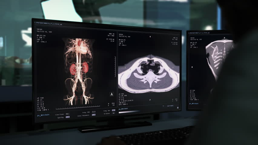 X-ray used for health analysis of the emergency patient at the hospital. X-ray health analysis of the body organs. Analysing the health condition of the patients kidneys with x-ray technology. Royalty-Free Stock Footage #1105014903