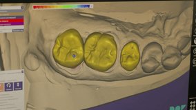 Using the modern dentistry computer program to model the artificial teeth. Changing the teeth size in the dentistry program interface. Adjusting the teeth in the jaw model in dentistry program. - Powered by Shutterstock - Get 15% off with code: PIKWIZARD15
