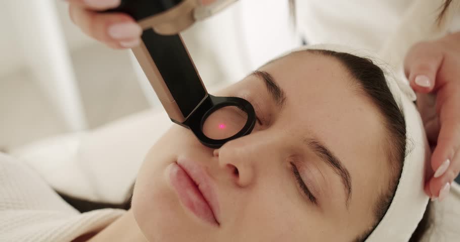 Close up of a young woman getting laser face treatment in a medical center, skin rejuvenation concept. Beautician cosmetologist doing procedure fractional microneedle. Beauty treatment. Royalty-Free Stock Footage #1105994403