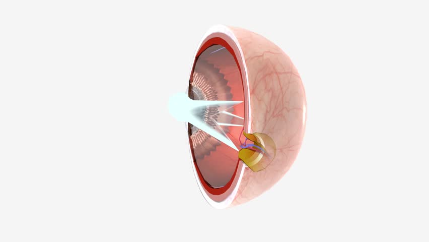 Astigmatism is a type of refractive error. Astigmatism occurs when the cornea or lens is curved more steeply in one direction than in another. Royalty-Free Stock Footage #1106097049