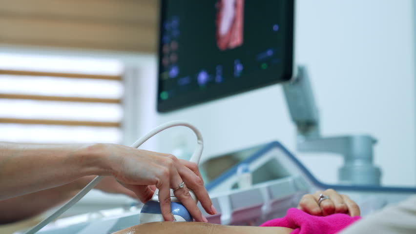 Ultrasonic check up for a Caucasain woman on early stage of pregnancy. Monitor of ultrasound machine at backdrop. Royalty-Free Stock Footage #1106105395