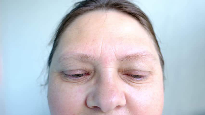 Upper part of woman's face, an elderly woman close-up, small and large mimic wrinkles, eyes with spots, concept of poor vision, eye fatigue, drooping eyelid, correction of elasticity of aging skin | Shutterstock HD Video #1106220465