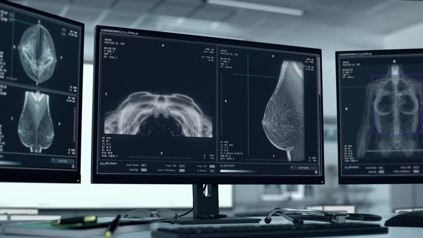 Mammography Imaging Technology Radiology Scan For Female Health Analysis. Radiology X-ray Scan. Female Health Examination. Radiology Medical Scan Software. Female Health Breast Cancer Screening Royalty-Free Stock Footage #1106364857