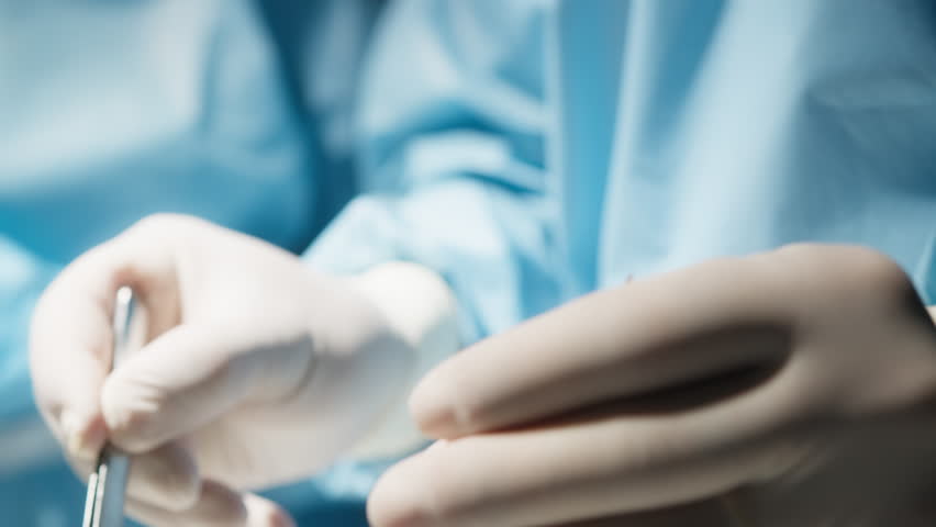 Hands of a surgeon use forceps and scalpel during stomach operation Royalty-Free Stock Footage #1106445547