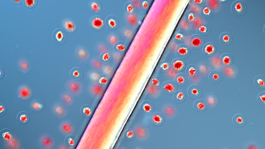 Blood Rain Alga Haematococcus and a human hair under the microscope visualising the dimensions of microorganisms in polarised light