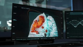 Patient Lung Cancer Illness Data Analysis. High Risk Patients Illness Oncological Analysis Via Modern Scanning Equipment. Futuristic Medical Patient Illness Analysis At A Scientific Laboratory. - Powered by Shutterstock - Get 15% off with code: PIKWIZARD15