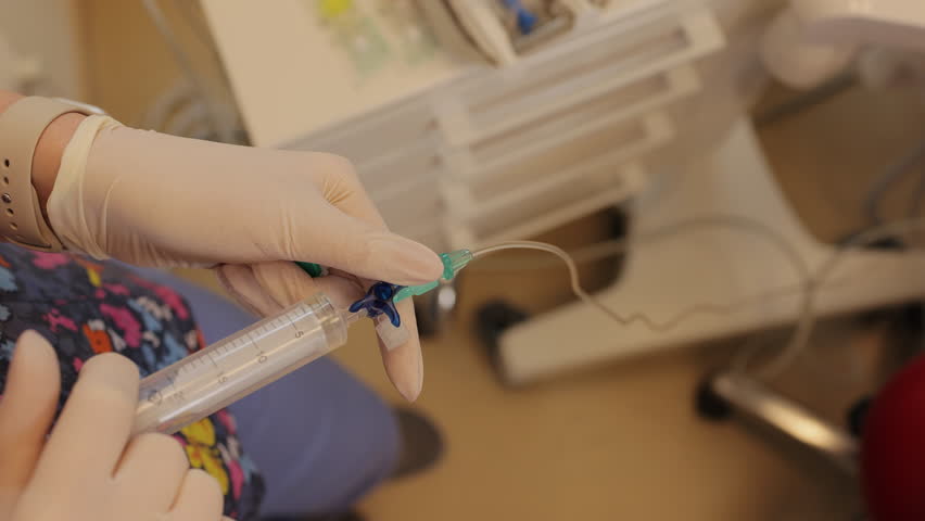 Injection of a catheter of a patient. Anesthesiologist or doctor put medicine in catheter for test and relief the pain. Epidural analgesia. Epidural nerve block. Royalty-Free Stock Footage #1106953447