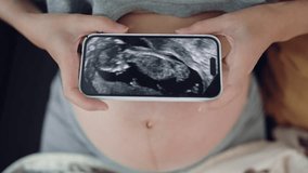 Pregnant women looking ultrasound video her baby on smartphone. Close up ultrasound video on smartphone. Third trimester pregnancy. Gynecology birth childbirth, Pregnancy concept