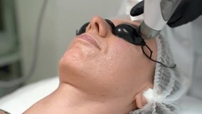 anti-aging modern cosmetology  procedure Transdermal Mesotherapy product serum penetrate the skin under the influence of strong air pressure. Video footage. patient in black protective goggles
