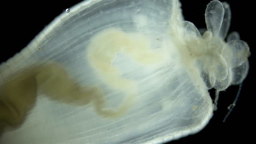 Cactus worm Priapulus caudatus under microscope, phylum Priapulida. Predator, feeds on Polychaeta, detritus. In video, tail appendage. White sea