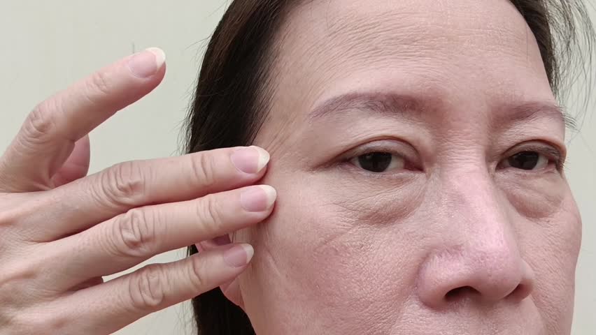 Middle-aged women have wrinkles on their faces, acne, freckles, scars on their faces.
 | Shutterstock HD Video #1107696415