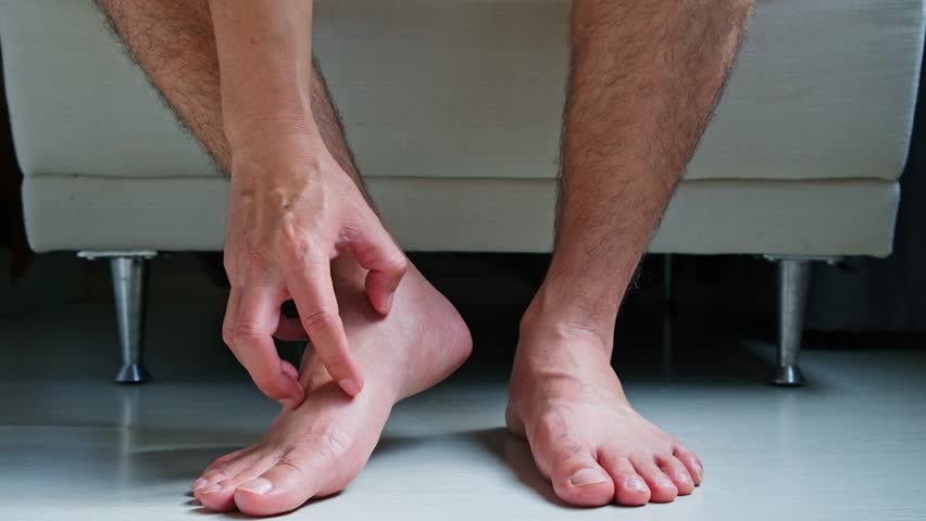 Men wear canvas shoes, he scratches legs and feet with itchy skin. Caused by  of shoes Royalty-Free Stock Footage #1107827463