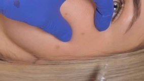 A surgeon in medical gloves makes injections into the skin of a girl's face. Vertical video