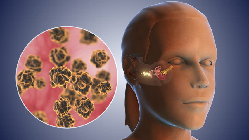 Ear wax bacterial infection medical concept