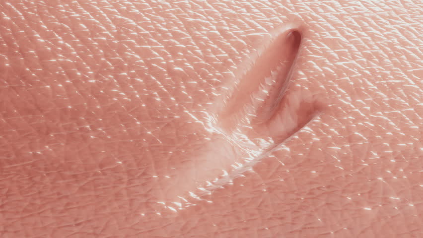Laser Skin Treatment. Removing Scars and skin surface repair. 3D Render Royalty-Free Stock Footage #1108617157