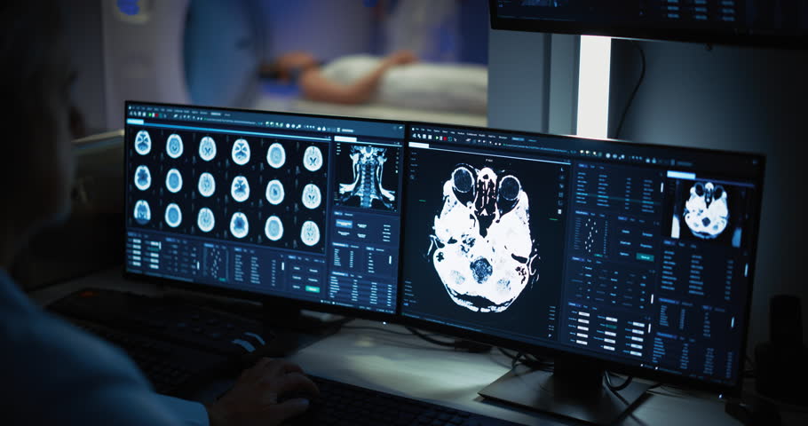 Medical Hospital Research Lab: Male Medical Scientist Using Computer with Brain Scan MRI Images of a Female Patient Undergoing Medical Process in the Background. Healthcare Service Royalty-Free Stock Footage #1108680995