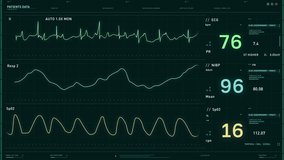 Interface Of Heart Rate Test Equipment Analyzes Patients Health Data. Electrocardiogram Machine Used For Heart Rate Test. Medical Clinic Equipment Testing Heart Rate Of Patient. Evaluating Heartbeat - Powered by Shutterstock - Get 15% off with code: PIKWIZARD15