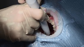 Dental Extreme Close up Macro Video. Dental Cleaning process in patient mouth. Clean teeth and gums use water jet and saliva ejector. Concept of professional dental hygiene. 4k 120 fps slow motion