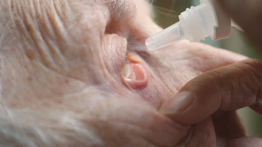 Profile of old woman dripping medical drops in her eye. Portrait of grandmother with infection and inflammation of eyes. Concept of healthcare and medicine. Side view Close up Slow motion | Shutterstock HD Video #1108788499
