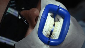 Dental Whitening process in patient mouth. Teeth whitening with UF Lamp, Led Lamp and gel. Dental Extreme Close up Macro Video. Concept of professional dental hygiene. 4k 120 fps slow motion footage