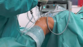 Knee Arthroscopy -Close-up. Surgeon Doctor Performs Restoration of Human Knee Joint Using Modern Arthroscopic Instruments - Close Up Zoom in - Powered by Shutterstock - Get 15% off with code: PIKWIZARD15