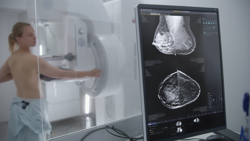 Adult woman stands topless undergoing mammography screening checkup in hospital radiology room. Computer control panel screen for activating mammogram machine. Breast cancer prevention. Modern clinic. | Shutterstock HD Video #1109279499