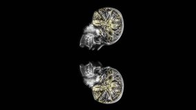 Neurons and neural connections. Neuronal activity in the brain, neurogenesis, neurotransmitters, electricity in the brain. Human brain.  Vertical, vertical video background. - Powered by Shutterstock - Get 15% off with code: PIKWIZARD15