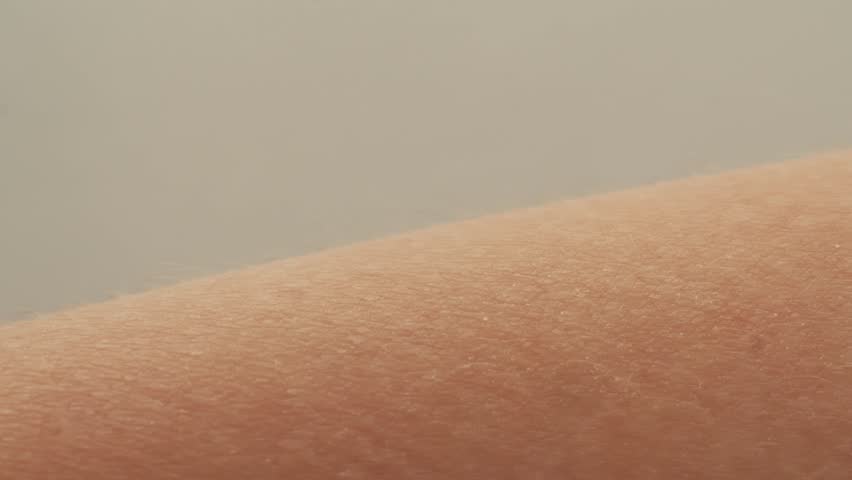 Hand surface with hair close-up. Human skin reaction to cold or fear, arm on black background, static electricity. 