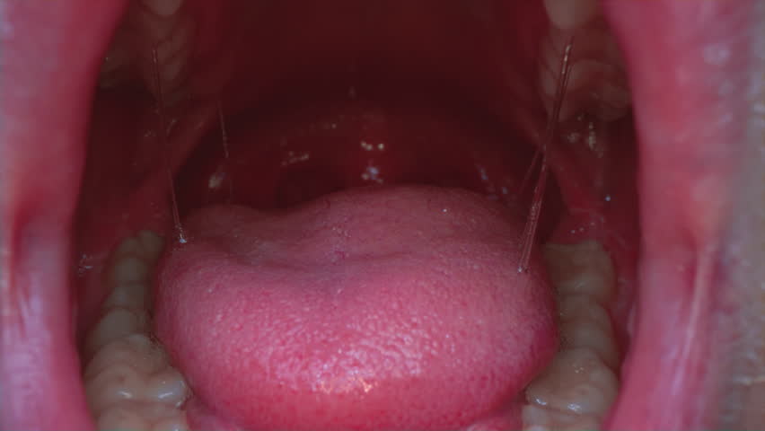 131 Uvula Stock Video Footage - 4K and HD Video Clips | Shutterstock