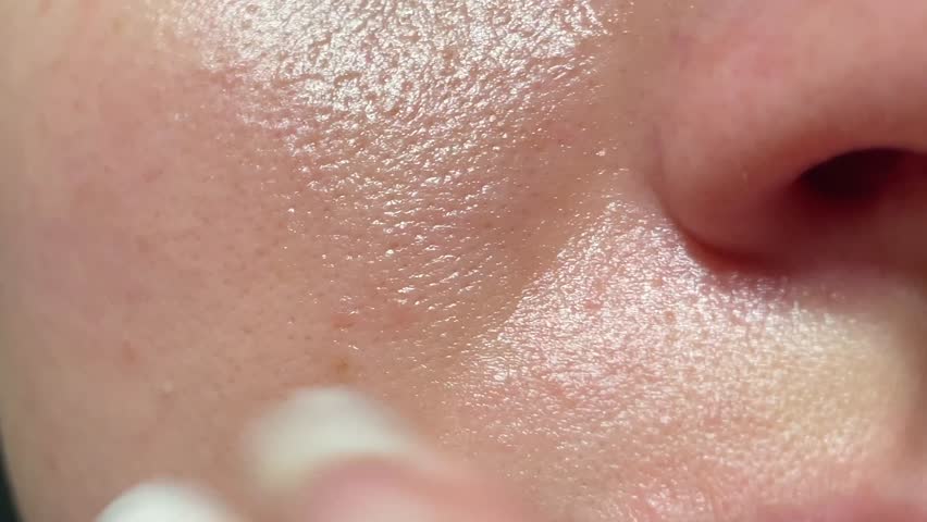 Macro video of big pore on oily facial skin type. Unhealthy oily facial skin with enlarged pores and shiny sebum, texture part of the face. Royalty-Free Stock Footage #1109861493