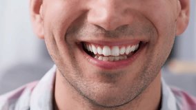 Happy perfect white teeth smile close up. American dental service clinic. Nice 30s person laugh. One fun young adult man. Joyful male guy face closeup. Oral tooth whitening stomatology. Dentistry care - Powered by Shutterstock - Get 15% off with code: PIKWIZARD15