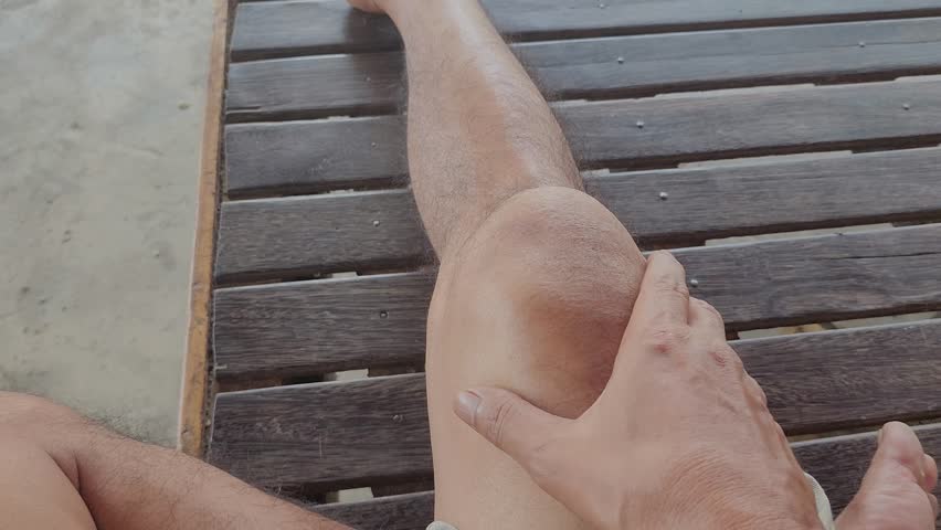 Ligament Sprains, Kneecap Dislocations, kneecap patella injuries due to direct impact with hard objects pain, soreness, bruising, and swelling of muscle tissue, Asia Indonesia | Shutterstock HD Video #1110012621