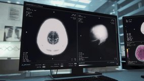 Medical analysis of the human brain at the hospital. Modern medical scanning mri equipment deals with the analysis of patients brain. Medical analysis diagnosing cancer in the brain. - Powered by Shutterstock - Get 15% off with code: PIKWIZARD15