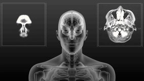 MRI scan of the human head and neck with the skull and Brain visible. Black and white 3d render animation of rotation. - Powered by Shutterstock - Get 15% off with code: PIKWIZARD15