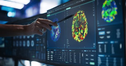 Modern Medical Research Center: Anonymous Doctor Pointing At Desktop Computer Monitor With Software Visualizing Human Brain Based On MRI Scan. Neurologist Looking For Impacted Areas By Brain Damage.: stockvideo