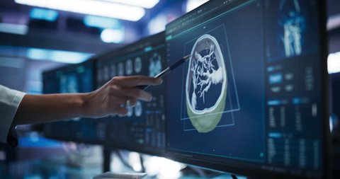Modern Cancer Research Medical Center: Anonymous Doctor Pointing At Desktop Computer Monitor With 3D Software Visualizing Human Brain Based On CT Scan. Neurologist Looking For Tumor In Patient's Brain Video stock