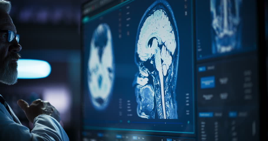 Medical Research Center: Close Up Portrait Of Caucasian Male Neurologist, Neuroscientist, Neurosurgeon, Looks at TV Screen with Brain MRI Scan Images, Thinks about Sick Patient Treatment Method. Royalty-Free Stock Footage #1110879709