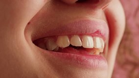 Close-up of young woman plump lips, moles on the face. Pink background. Nature beauty of female face skin - Powered by Shutterstock - Get 15% off with code: PIKWIZARD15