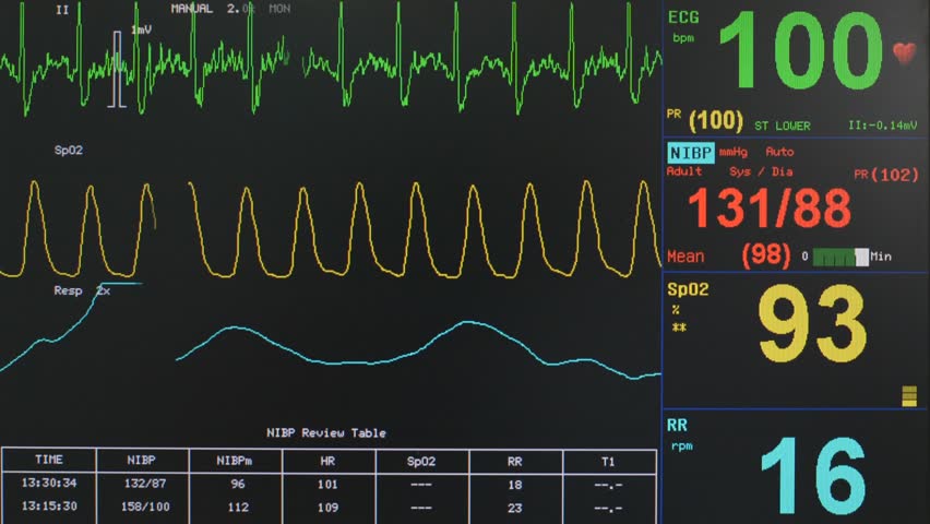 ecg heart rate monitor